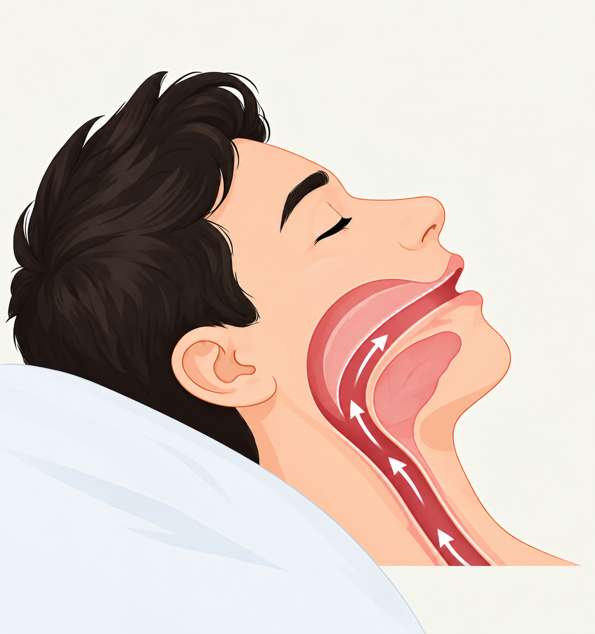 Sleep apnea